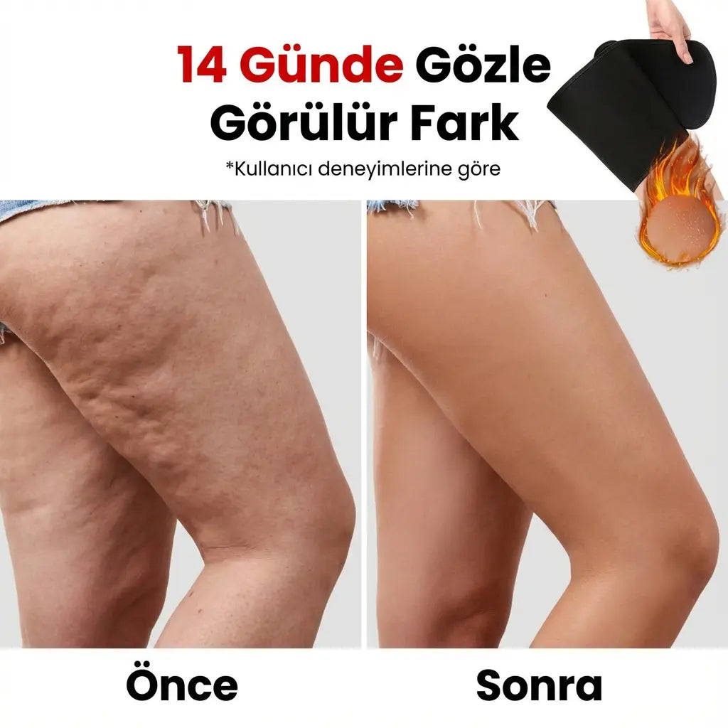 Selülit ve Sarkma Karşıtı Sıkılaştırıcı Bacak Şekillendirici